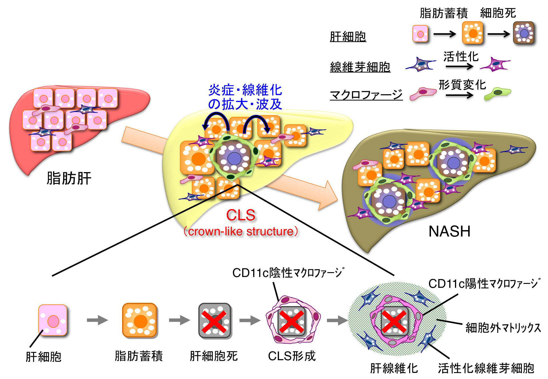 図:非アルコール性脂肪肝炎(NASH)の新たな病態メカニズムの解明