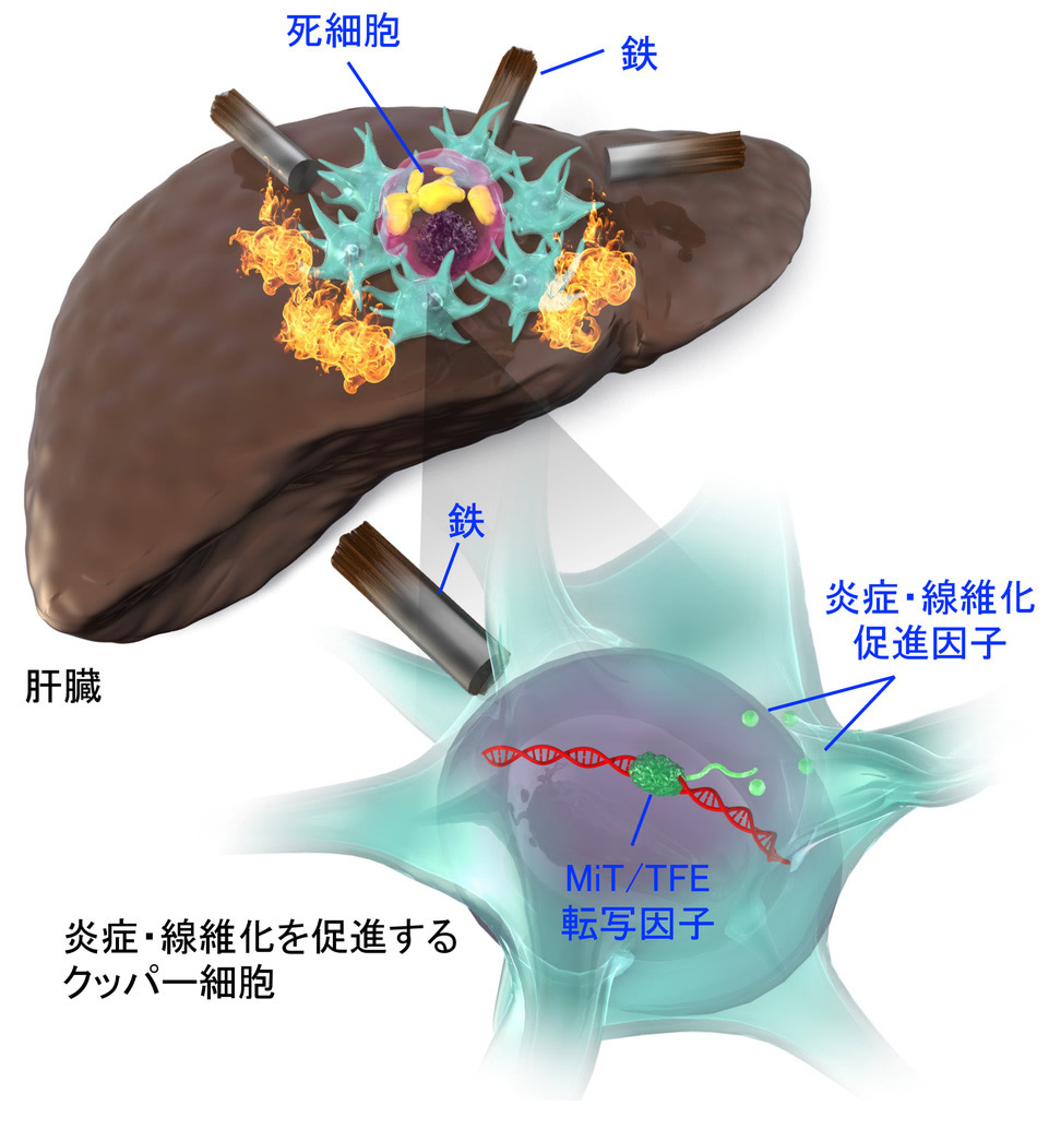 図:非アルコール性脂肪肝炎(NASH)の新たな病態メカニズムの解明
