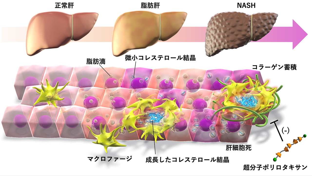 図:マクロファージへのコレステロール蓄積が肝線維化を促進する